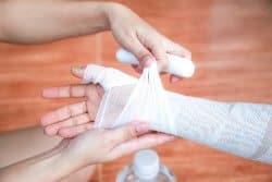 Burn Injury Lawyers in St. Louis MO