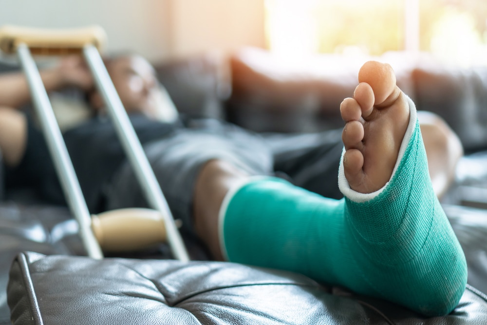 A close-up shot of a cast on a man’s leg
