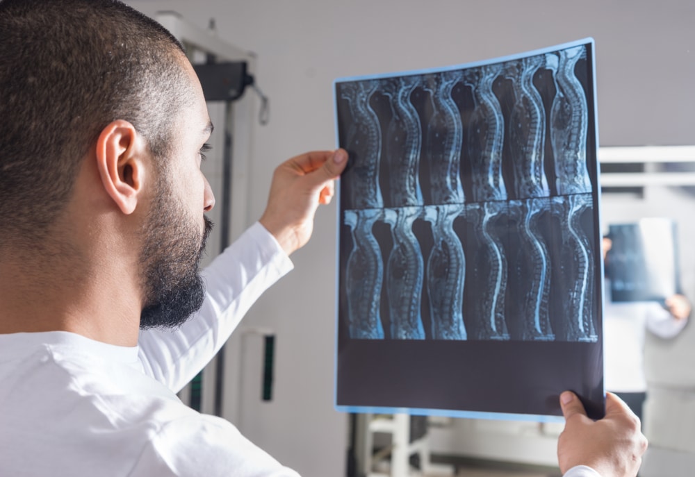 A doctor looking at spinal x-rays